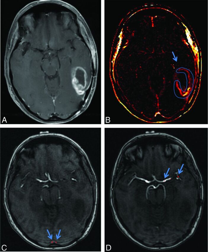 Fig 2.