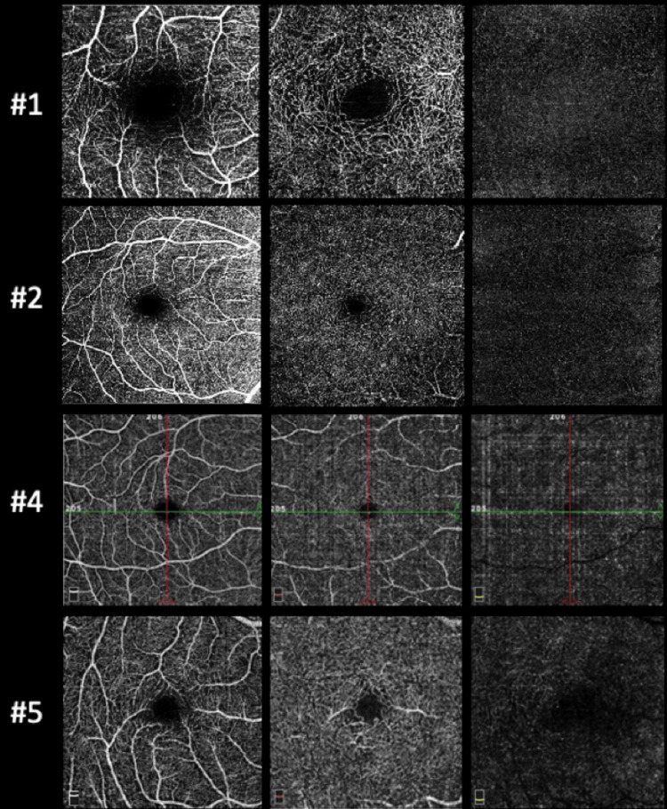 Figure 6