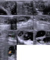 Fig 1