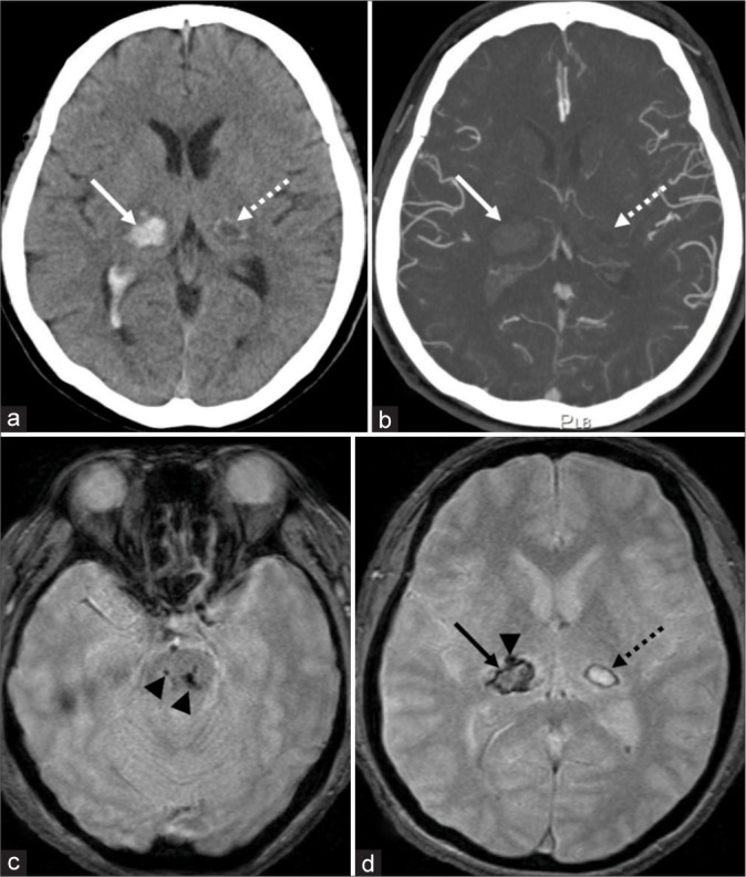 Figure 1: