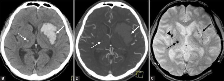 Figure 2: