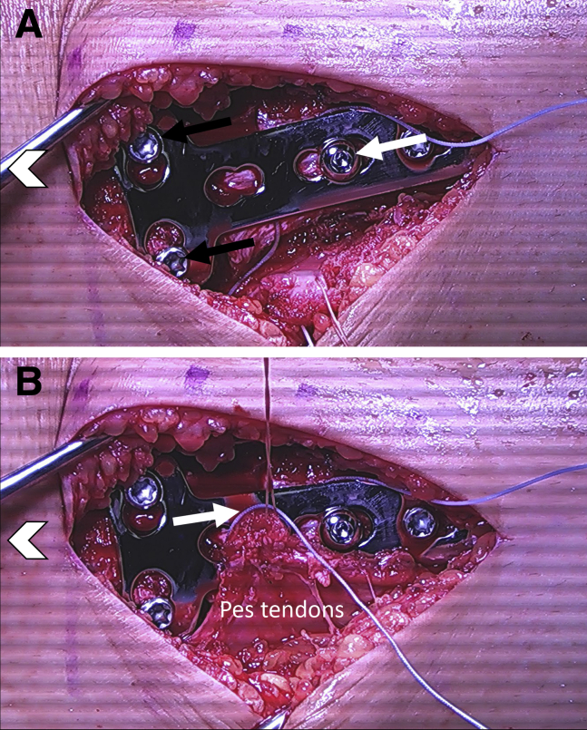 Fig 12