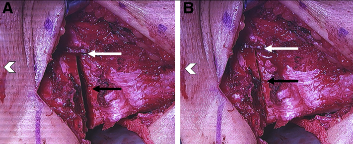 Fig 10