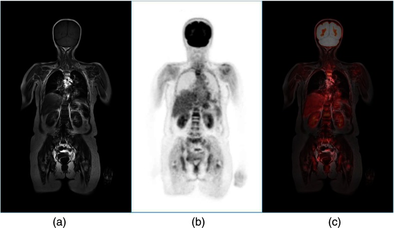 Fig. 14