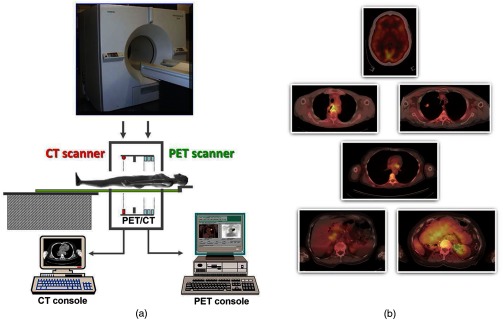 Fig. 11