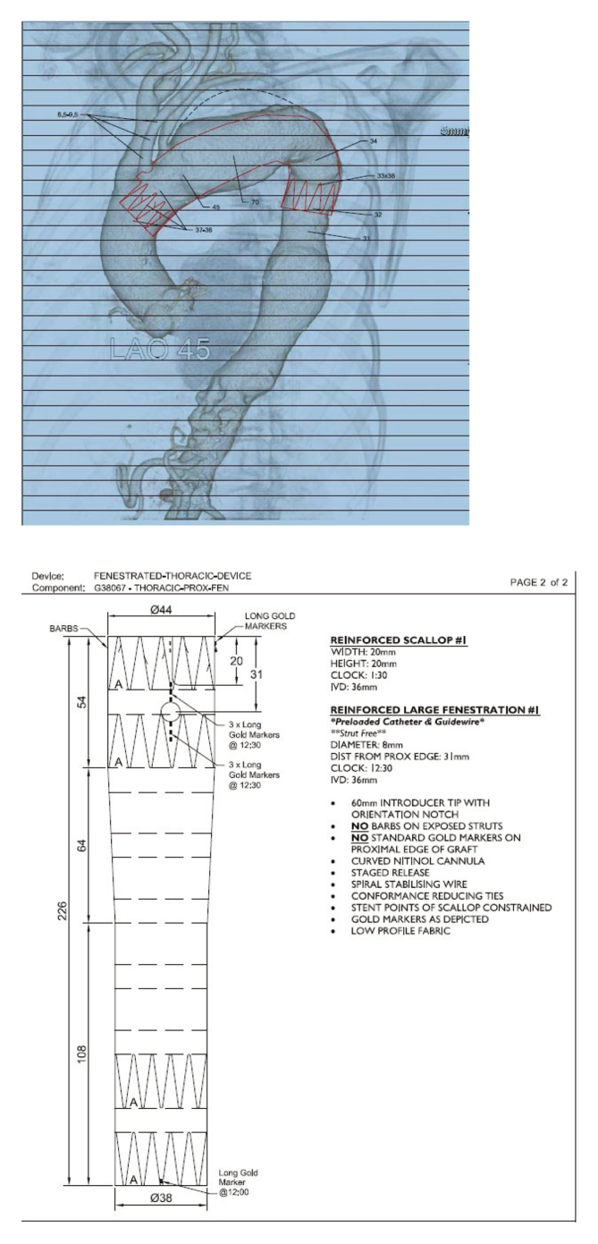 Figure 2