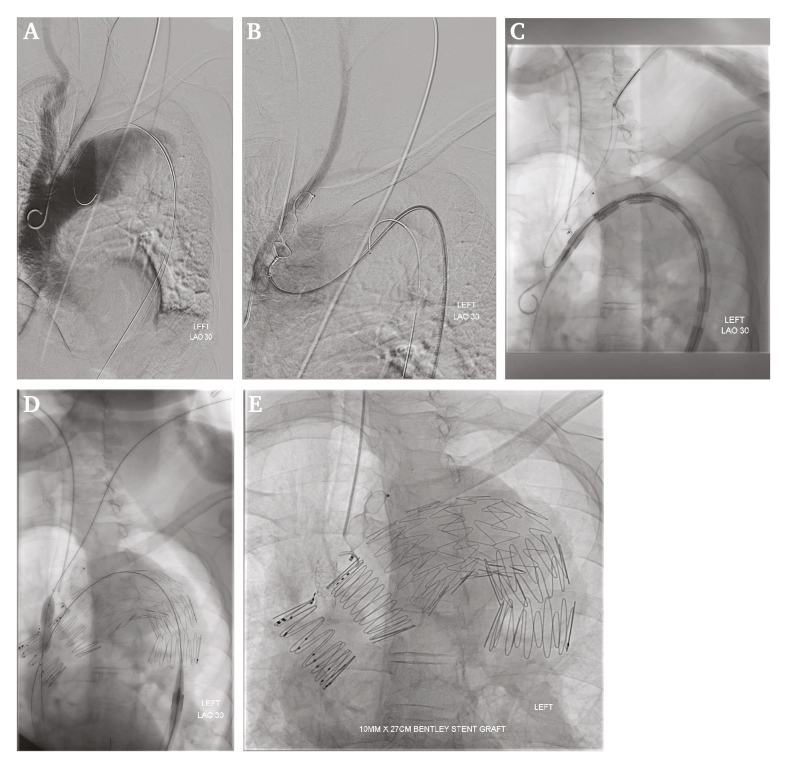 Figure 3
