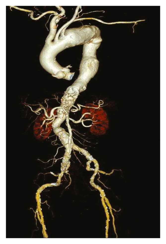 Figure 1
