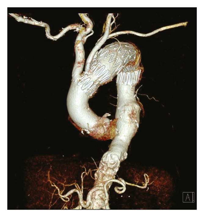 Figure 4