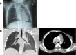 Figure1