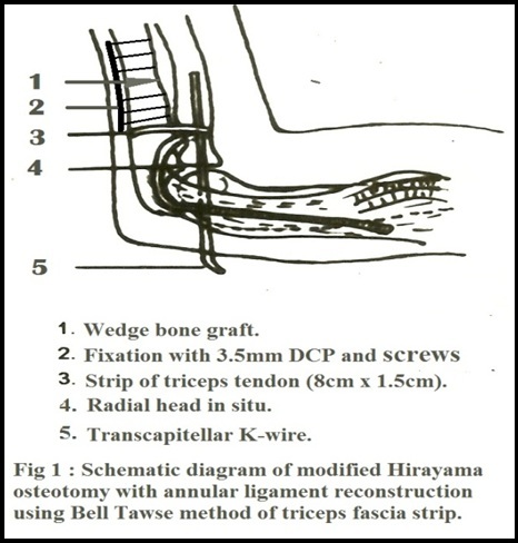 [Table/Fig-1]: