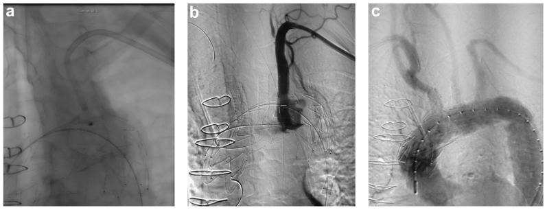 Fig 3