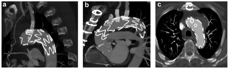 Fig 5