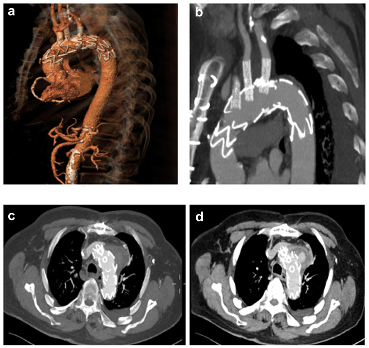 Fig 4