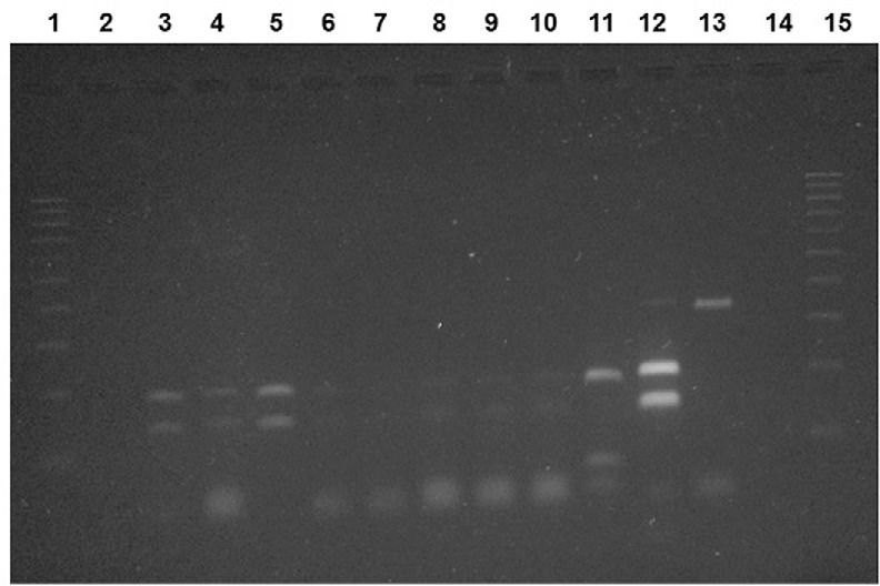 Digestion of amplified products from internal transcribed spacer 1 region
of Leishmania with HaeIII restriction enzyme.
Lane 1: ladder marker with 100 bp; 2: negative control (reaction without DNA
containing water); 3-10: sample of wild sandflies naturally infected by
Leishmania (Leishmania) amazonensis; 11: positive control
by Leishmania (Leishmania)infantum (MHOM/BR/1972/BH46); 12:
positive control L.
(L.)amazonensis(IFLA/BR/1967/PH8); 13: sample not digested by
HaeIII; 14: negative control (DNA from nonfed F1 females);
15: ladder marker of 100 bp.