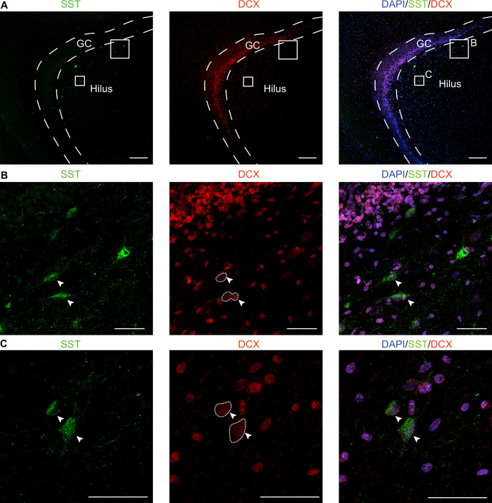 Figure 3—figure supplement 2.