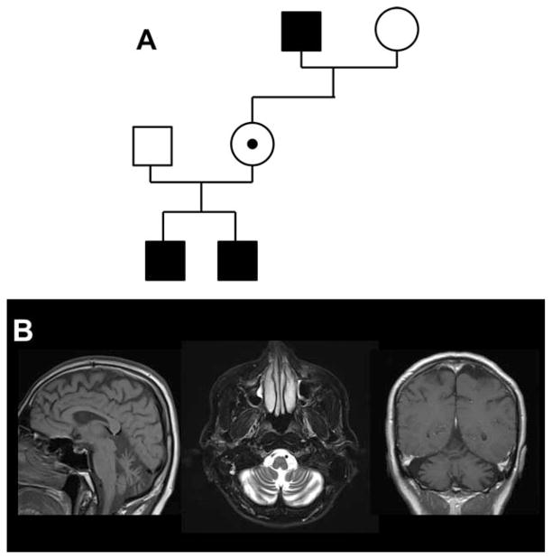 FIG. 1