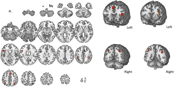 Figure 10