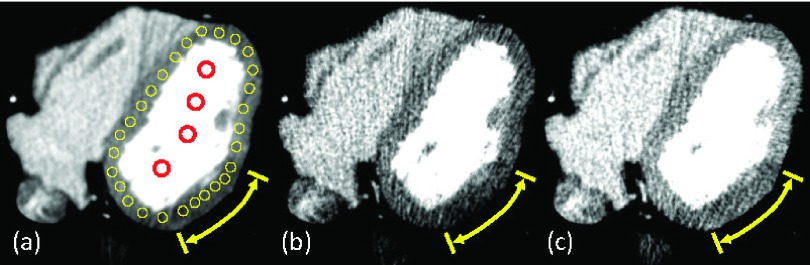 FIG. 5.