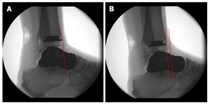 Figure 18