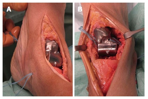 Figure 15