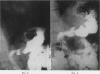 79