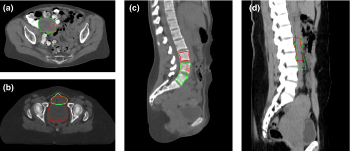 Fig. 6