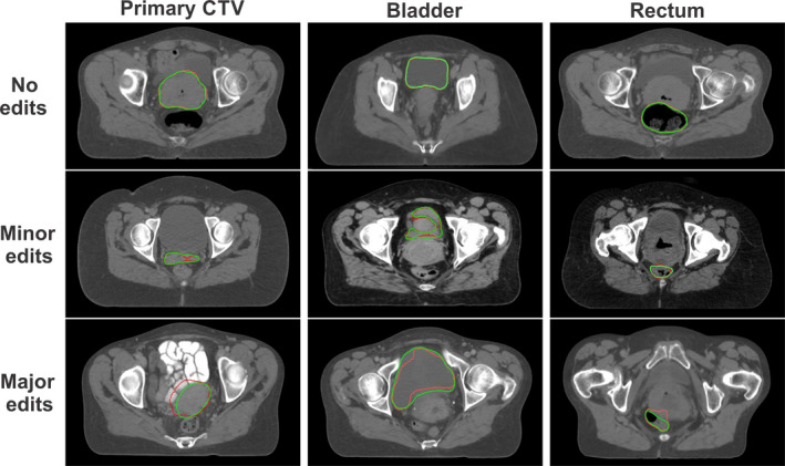 Fig. 7