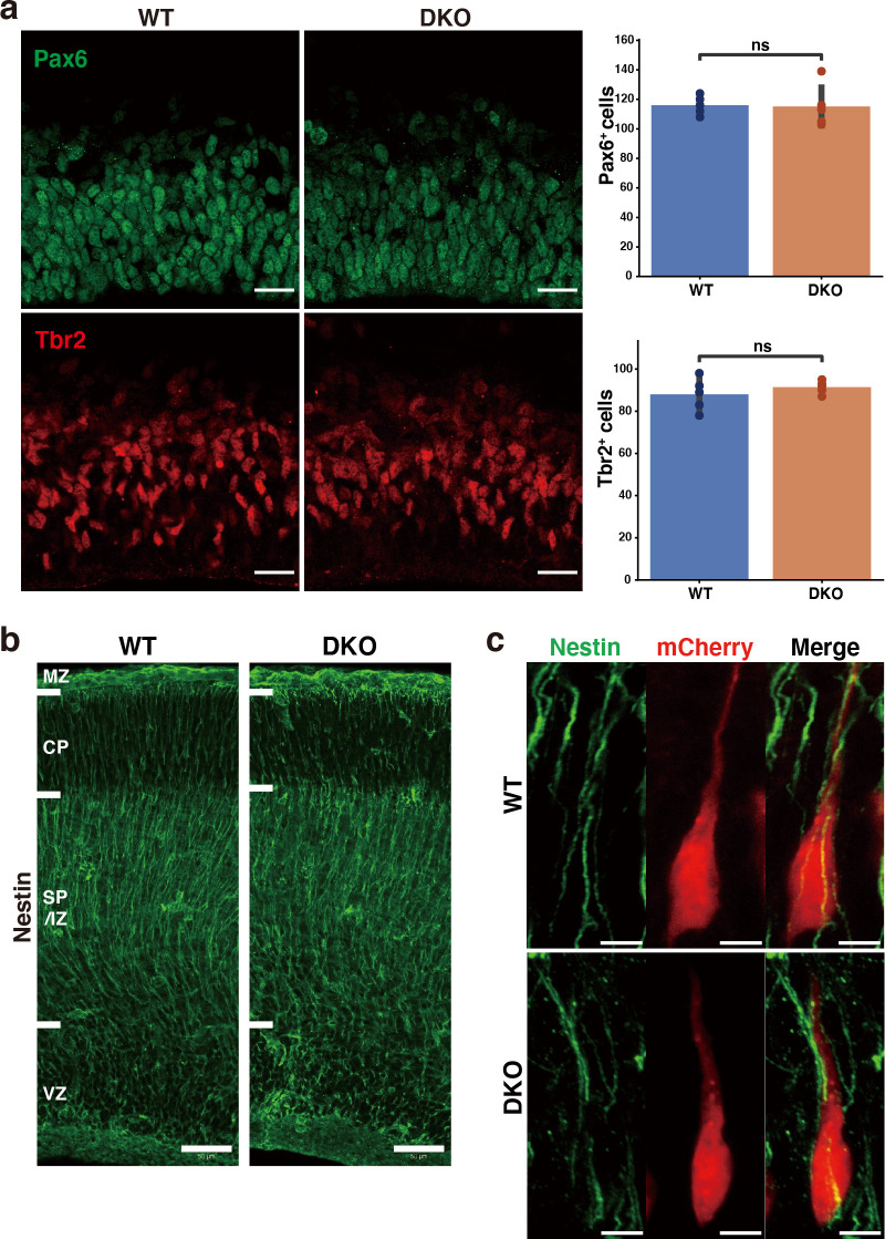 Figure 6—figure supplement 4.