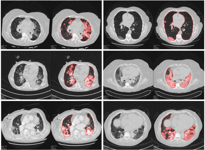 Fig. 6
