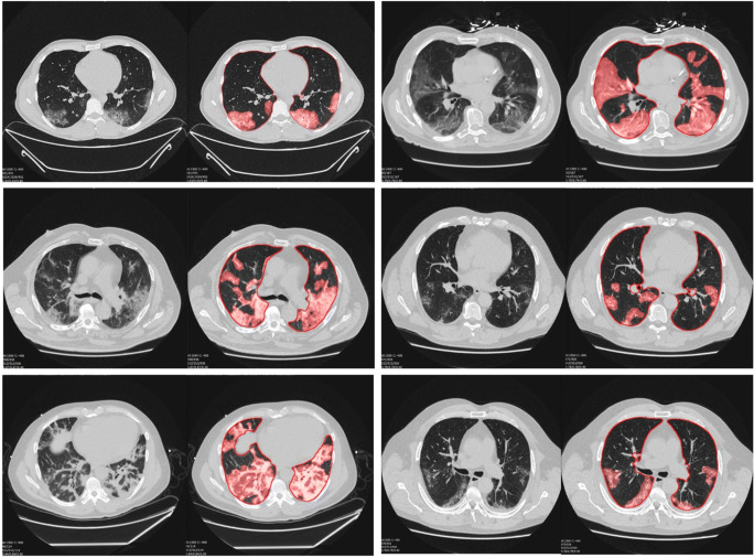 Fig. 5