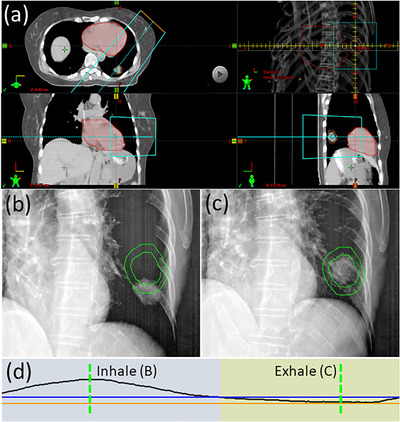 FIGURE 3