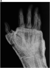 Fig. 2a