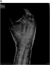 Fig. 2b
