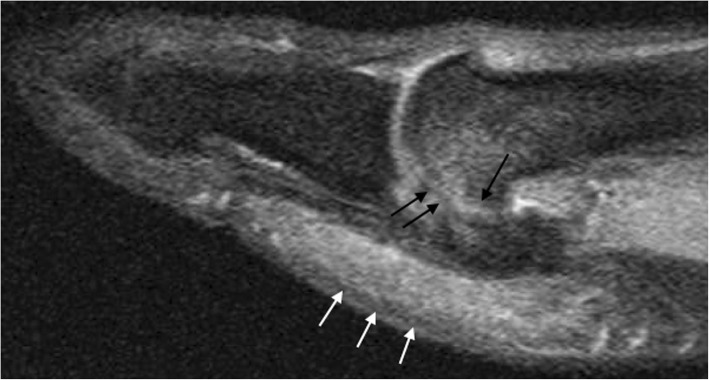 Fig. 12