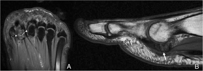 Fig. 13