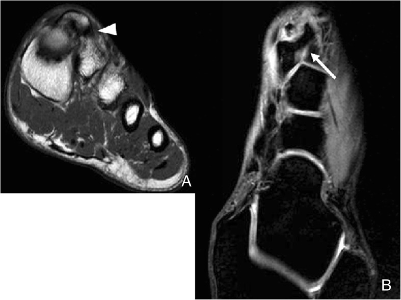 Fig. 18