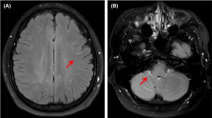 FIGURE 1