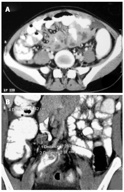 Figure 14