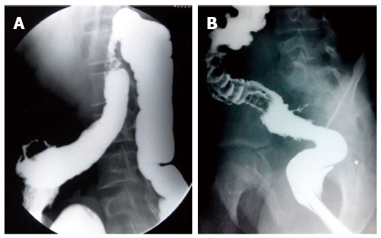 Figure 16