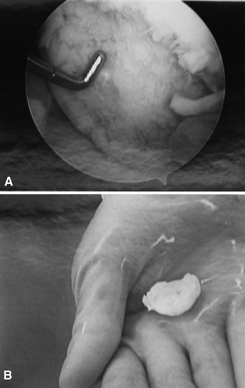 Fig. 4A–B