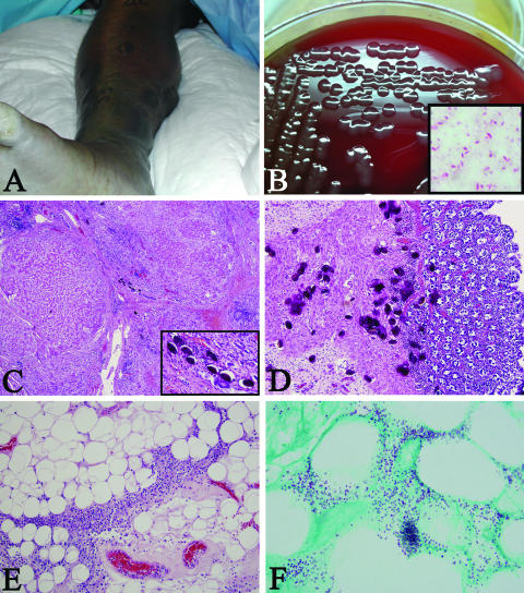 FIG. 1.