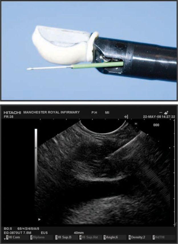 Fig 3.