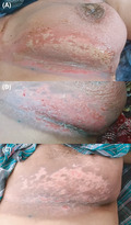 graphic file with name CCR3-9-e04661-g001.jpg