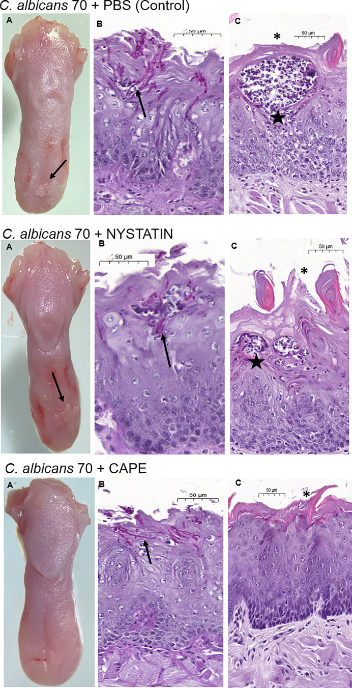 Figure 11