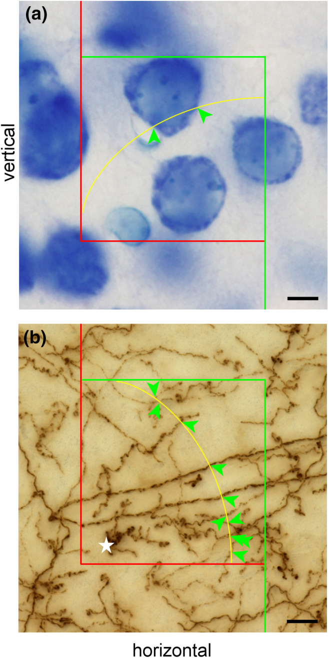 FIGURE 35