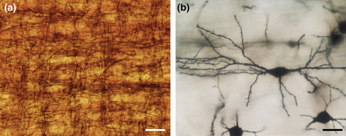 FIGURE 25