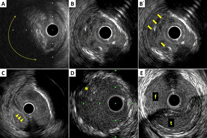 Fig. 5