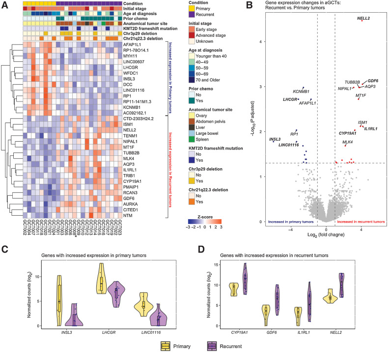 Comparative Tumor Microenvironment Analysis Of Primary And Recurrent