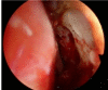 Fig. 2
